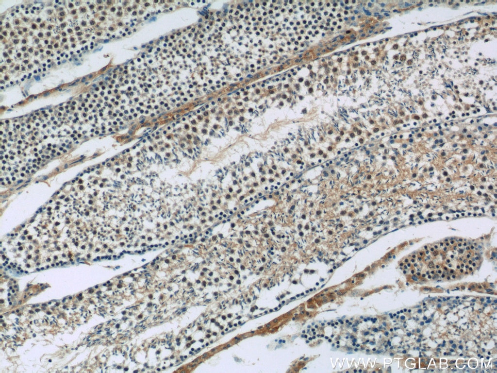 IHC of paraffin-embedded mouse testis tissue slide using 13161-1-AP( SIRT1 Antibody) at dilution of 1:50 (under 10x lens)