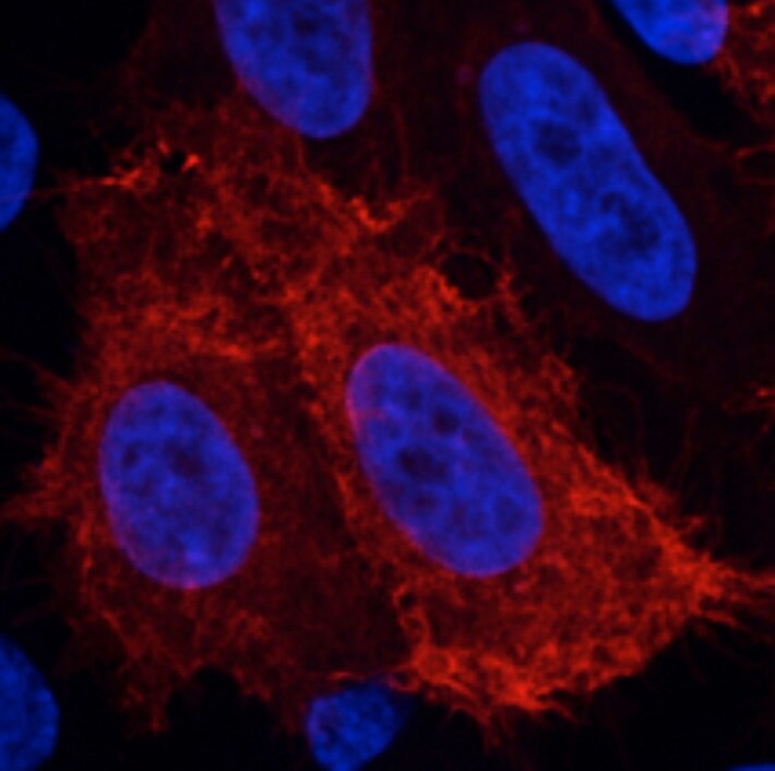 Immunofluorescence of HeLa cells transiently expressing MAG-myc