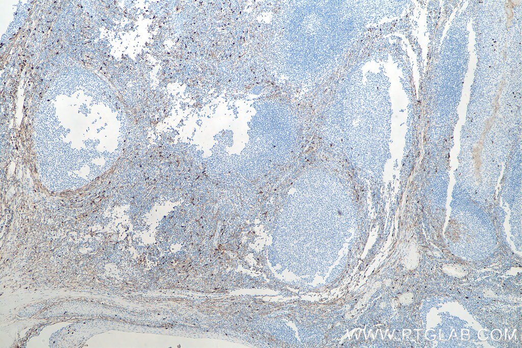 CD13 Antibody IHC human tonsillitis tissue 66211-1-Ig