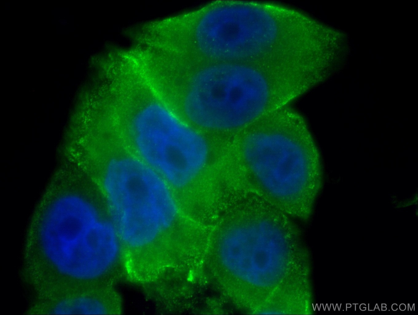 Annexin A2 Antibody IF HeLa cells 11256-1-AP