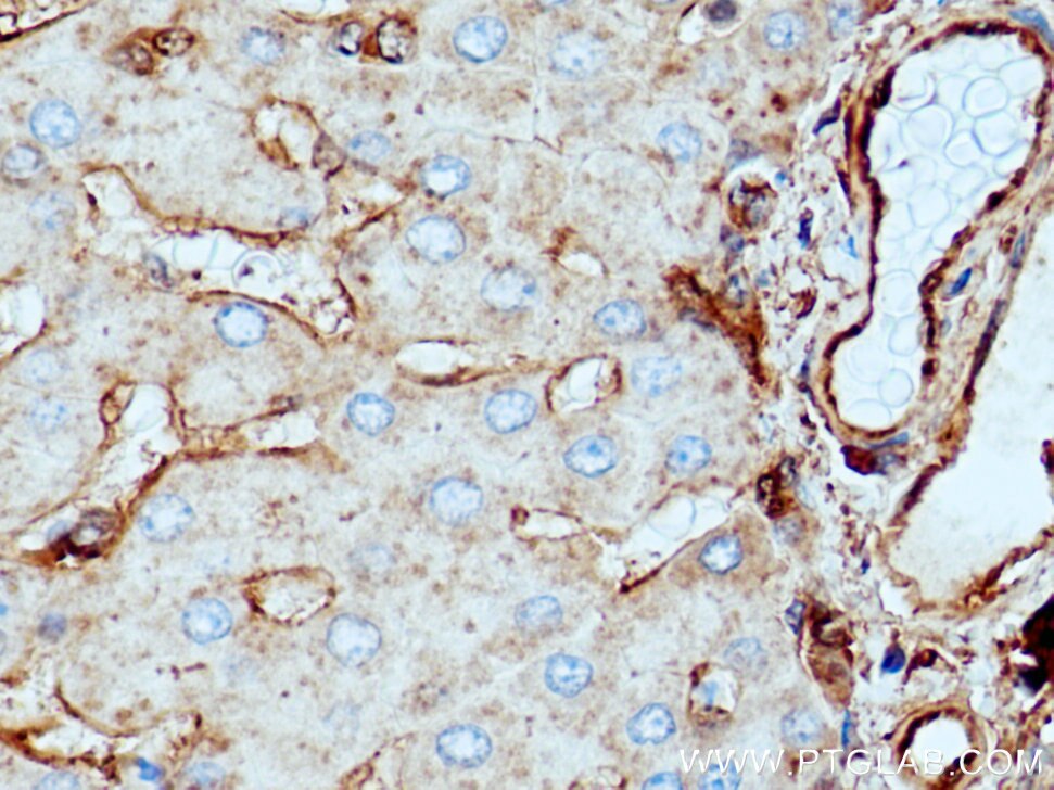 Annexin A2 Antibody IHC human hepatocirrhosis tissue 11256-1-AP