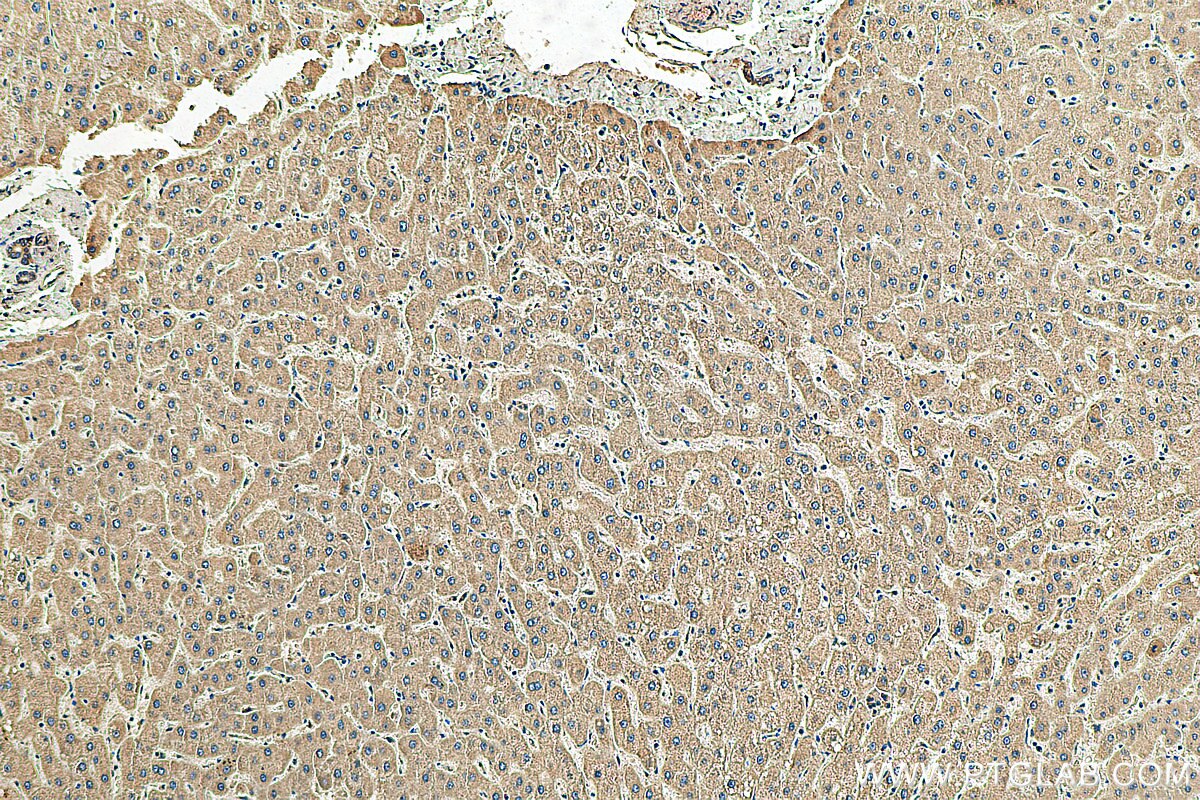 Apolipoprotein CIII Antikörper (22262-1-AP) | Proteintech