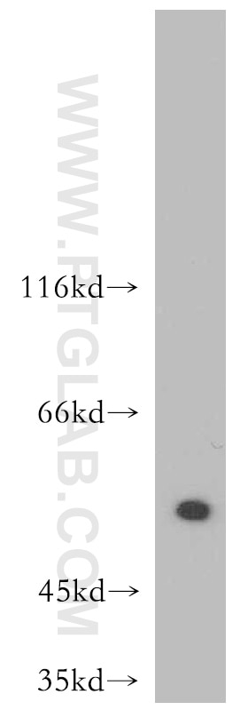 WB analysis of A431 cells using 10835-1-AP