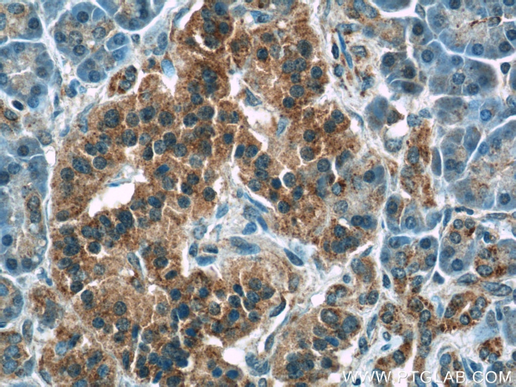 IHC staining of paraffin-embedded human pancreas tissue slide using ATF6 antibody (24169-1-AP) at a dilution of 1:50 (40x objective)
