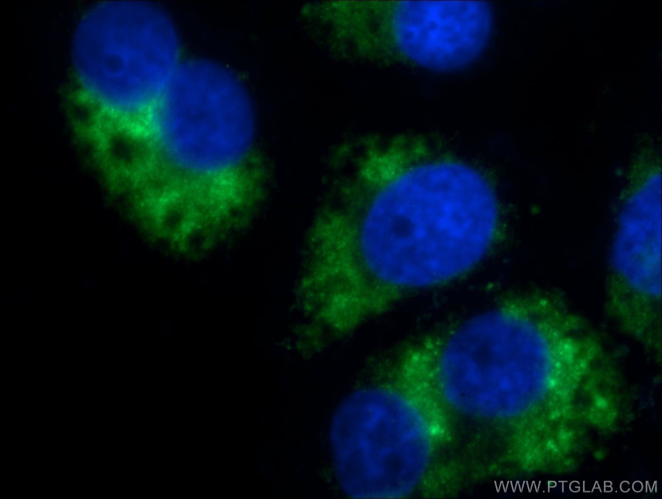 IF analysis of HepG2 cells treated with chloroquine using GABARAPL1-Specific antibody (ATG8L, 11010-1-AP; 1:50, 40x) and Alexa Fluor 488-congugated AffiniPure Goat Anti-Rabbit IgG(H+L)