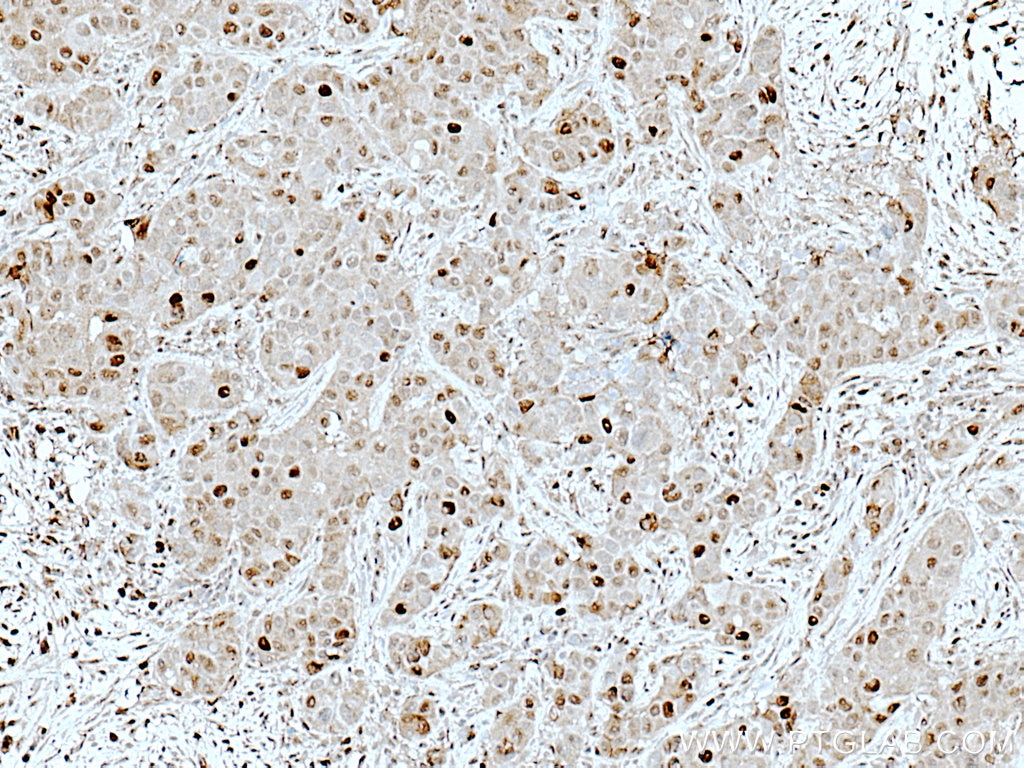 atm antibody 27156 1 ap proteintech