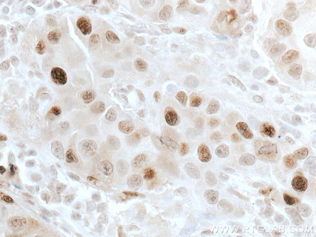 atm-antibody-27156-1-ap-proteintech