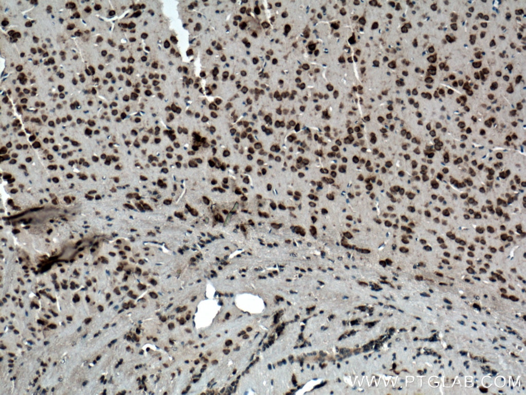 Ataxin 2 Antibody IHC mouse brain tissue 21776-1-AP