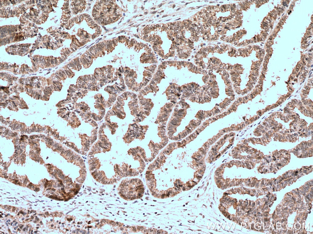 osteoid mesothelioma