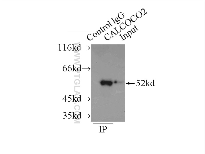 NDP52 Antibody IP HeLa cells 12229-1-AP