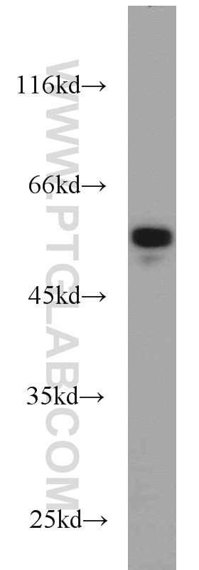 NDP52 Antibody WB Jurkat cells 12229-1-AP