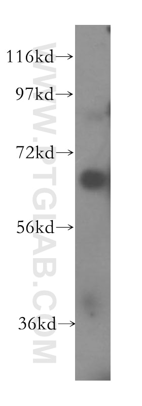 CD33 Antibody WB K-562 cells 17425-1-AP