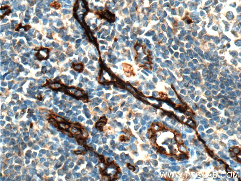 CD34 Antibody IHC human tonsillitis tissue 14486-1-AP
