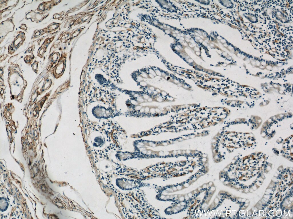 CD34 Antibody IHC human small intestine tissue 14486-1-AP