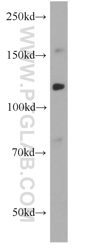 CD34 Antibody WB HL-60 cells 14486-1-AP