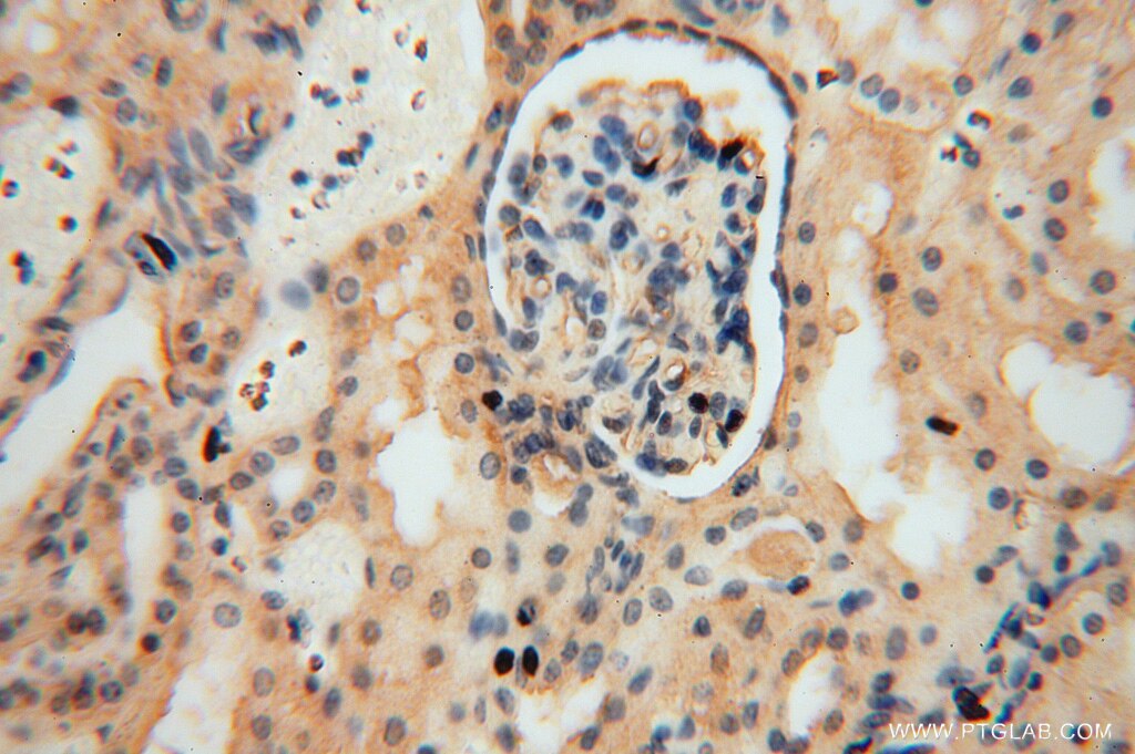 cd36 antibody 11378-1-ap pview