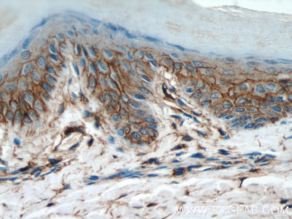 CD44 Antibody IHC human skin tissue 15675-1-AP