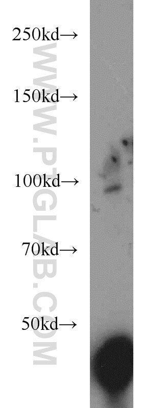 COPG2 antibody (16111-1-AP) | Proteintech