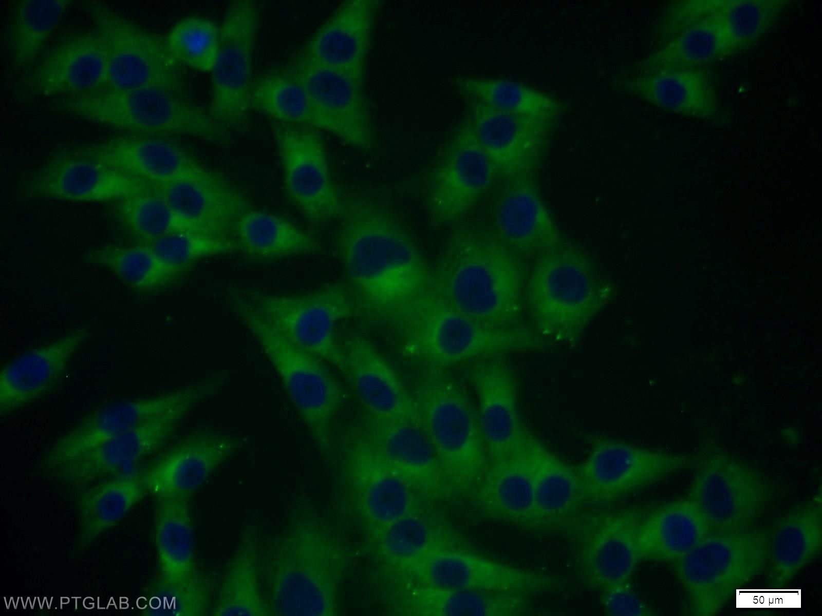 Cathepsin B Antibody IF A375 cells 12216-1-AP