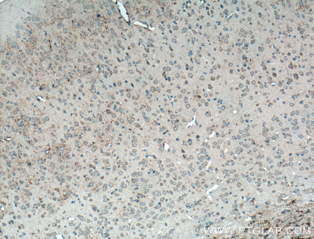 CX3CR1 Antibody IHC mouse brain tissue 13885-1-AP