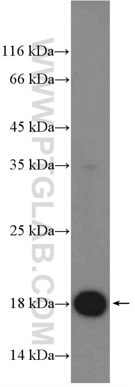 Recombinant protein was subjected to SDS PAGE followed by western blotting with Cas9-specific antibody (26758-1-AP) at a dilution of 1:3000