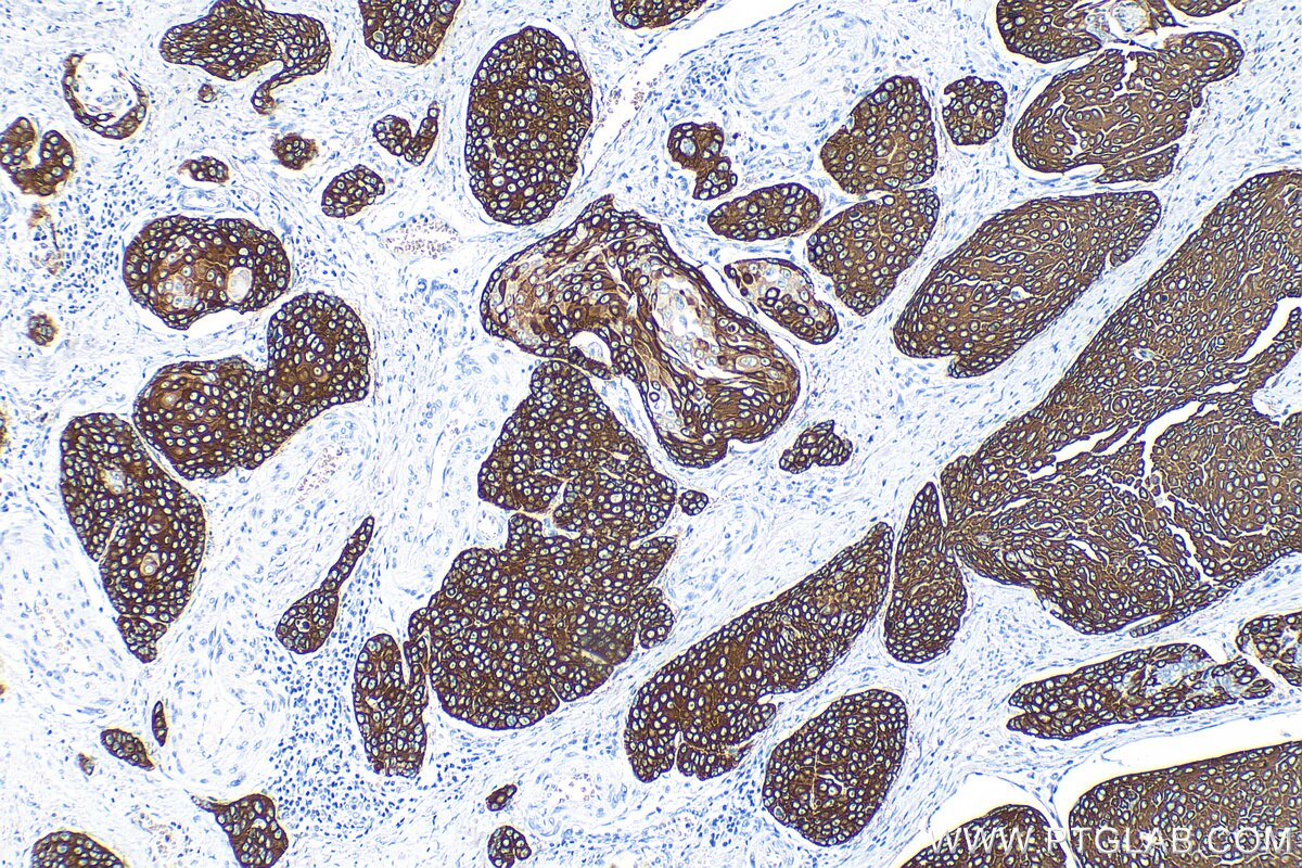 Anti Cytokeratin 14, Recombinant Antibody（PGI-828241RR