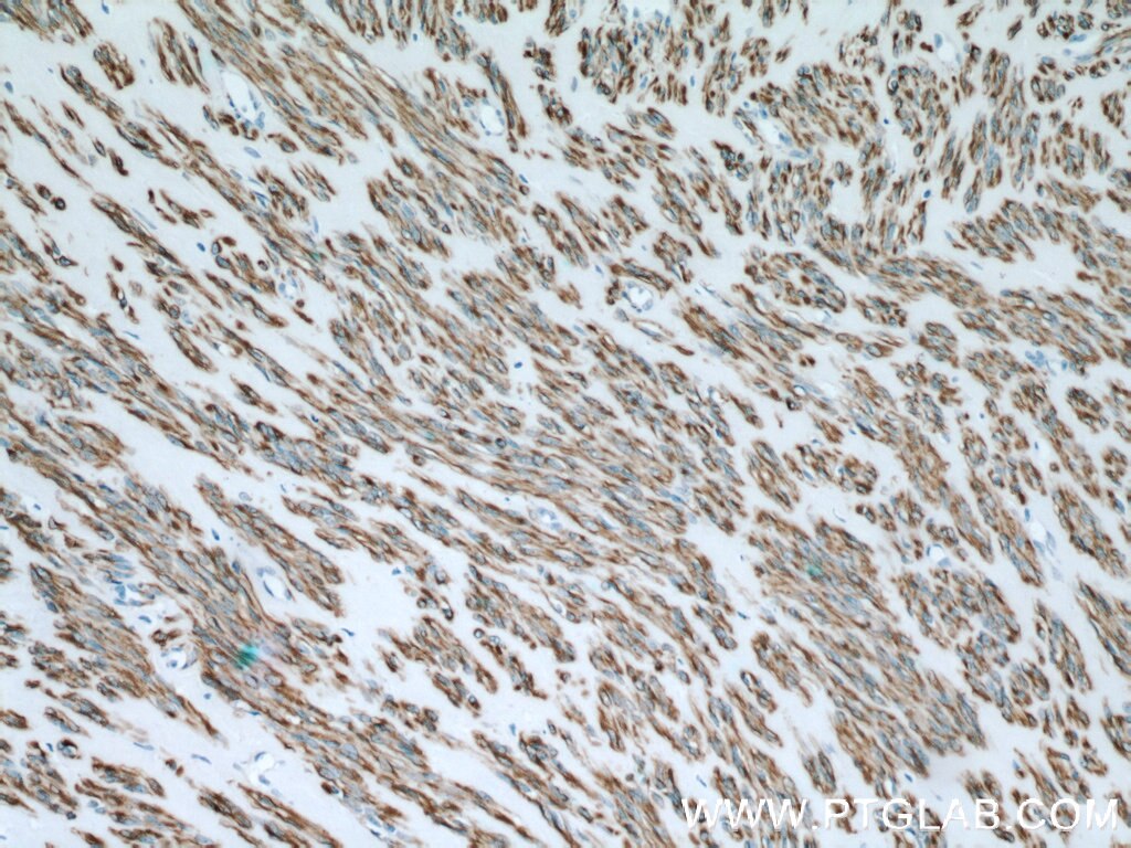 desmin antibody 16520-1-ap pview