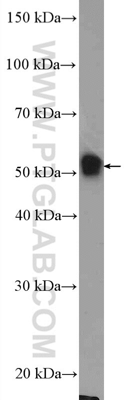 Antibody Stability At Room Temperature Antibody Stability At Room Temperature