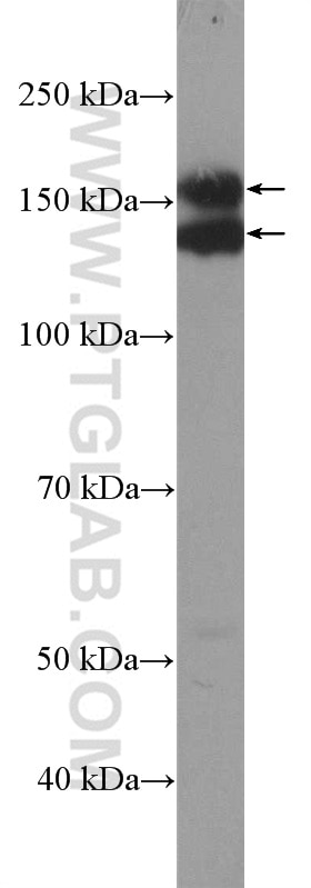 EGFR-Specific Antibody WB A431 cells 18986-1-AP