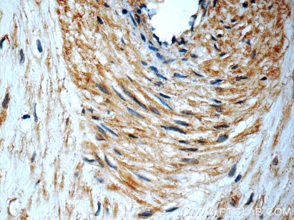 IHC staining of paraffin-embedded human placenta slide using PERK antibody (24390-1-AP) at a dilution of 1:50