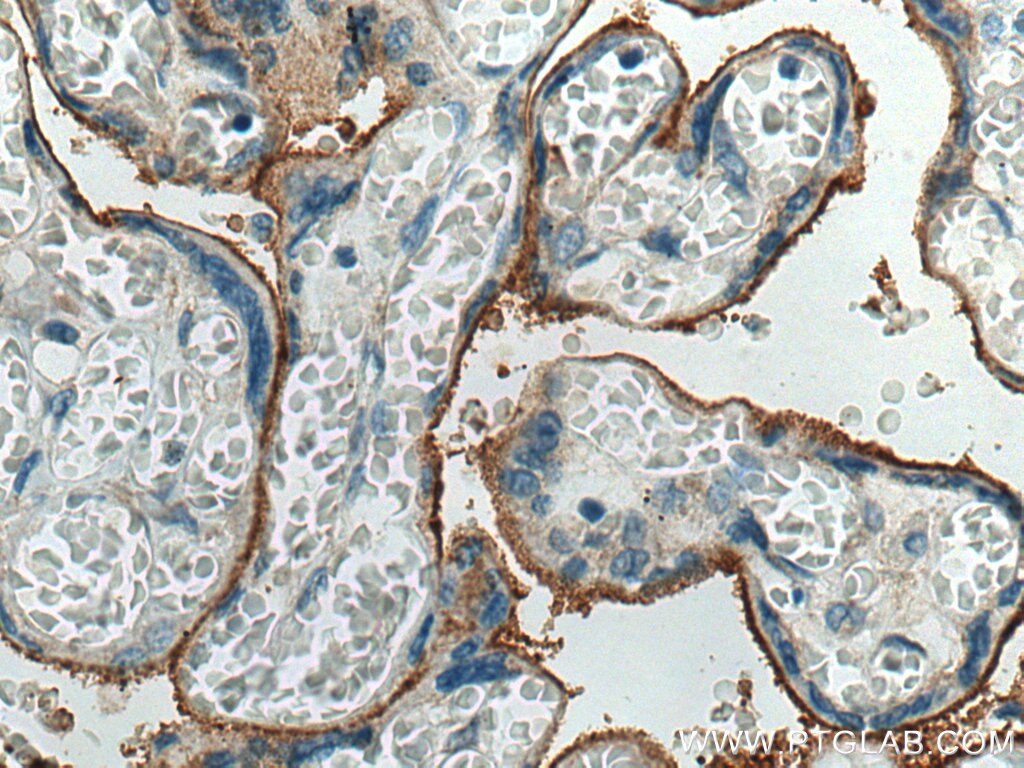Endoglin/CD105 Antibody IHC human placenta tissue 10862-1-AP
