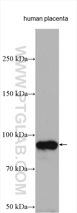 Endoglin/CD105 Antibody WB human placenta tissue 10862-1-AP