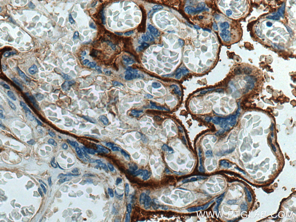 Endoglin/CD105 Antibody IHC human placenta tissue 28117-1-AP