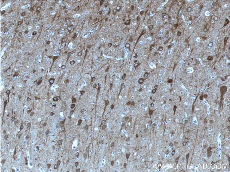 NSE Antibody IHC human brain tissue 10149-1-AP