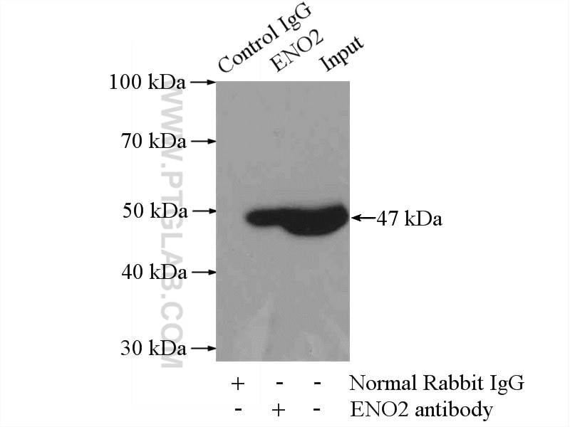 NSE Antibody IP mouse brain tissue 10149-1-AP