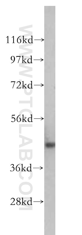 NSE Antibody WB mouse brain tissue 10149-1-AP