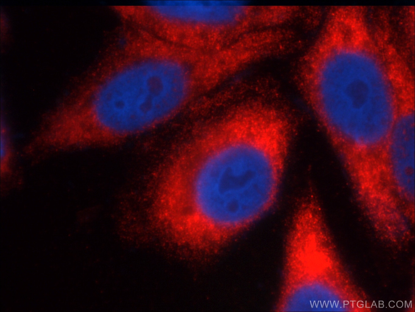 IF analysis of fixed HepG2 cells using 13755-1-AP (FMR1 Antibody)