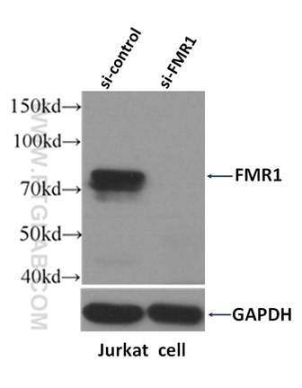 Western Blot result of FMR1 antibody (13755-1-AP, 1:1500) with si-Control and si-FMR1 transfected Jurkat cells. FMR1 gene has many isoforms with MW 59-72 kDa.
