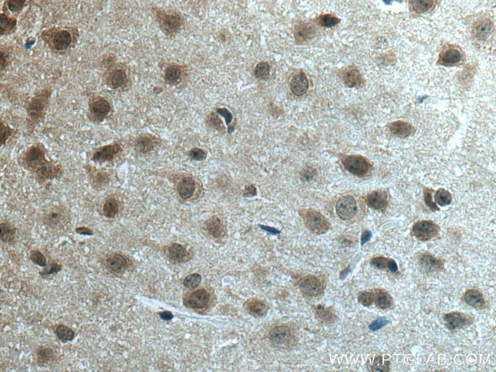 c-Fos Antibody IHC mouse brain tissue 26192-1-AP