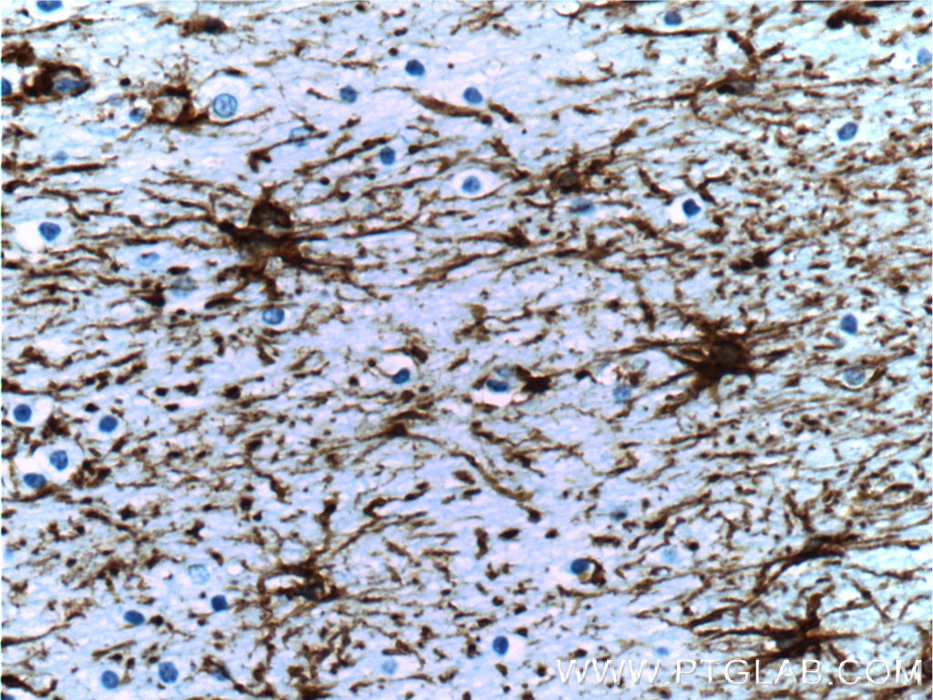 IHC of paraffin-embedded human brain tissue slide using 60190-1-Ig( GFAP Antibody) at dilution of 1:5000 (under 40x lens). Heat mediated antigen retrieved with Citric acid buffer, pH6.0