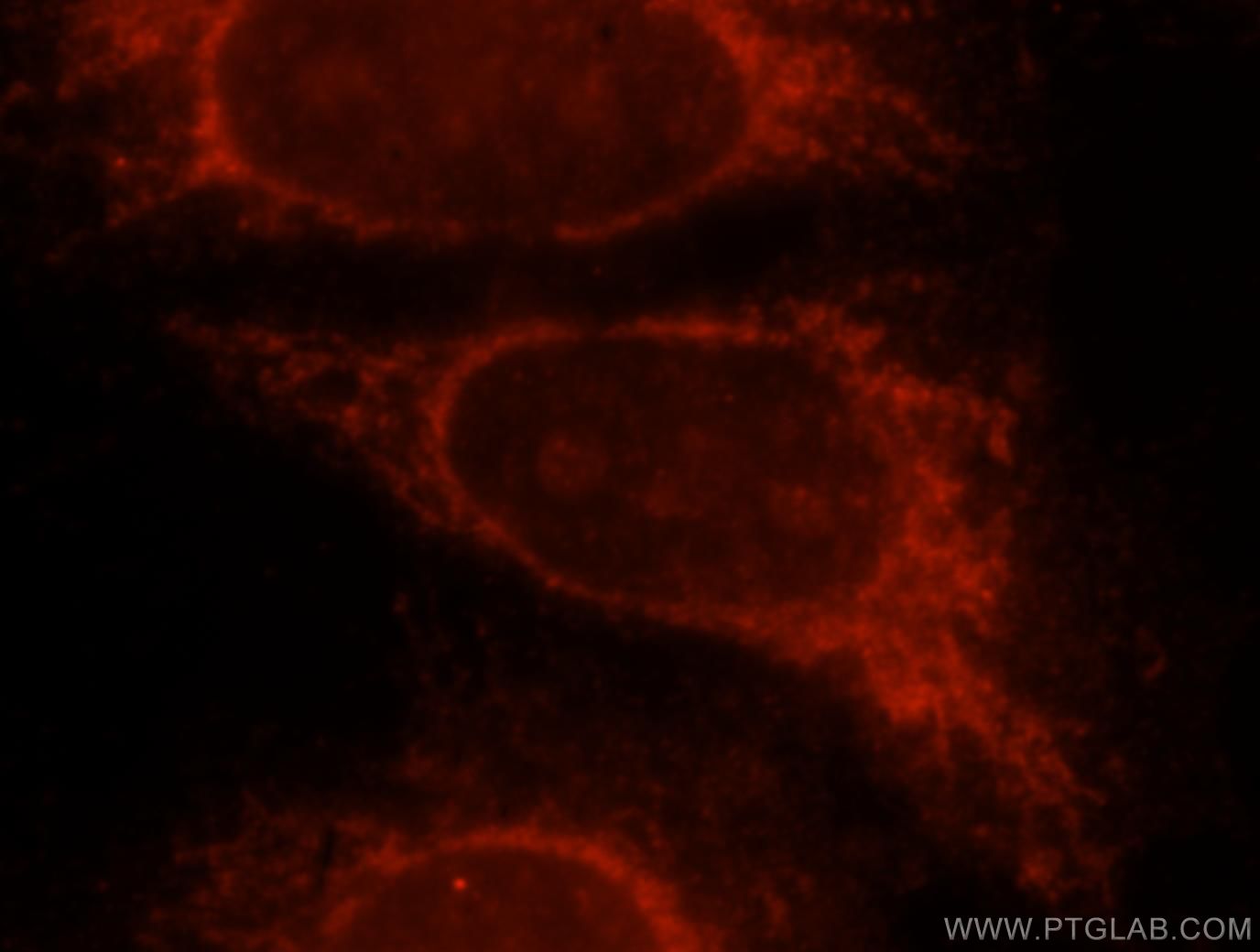 Immunofluorescent analysis of Hela cells using GLB1 antibody at 1.25 dilution and Rhodamine-labeled goat anti-rabbit IgG (red)