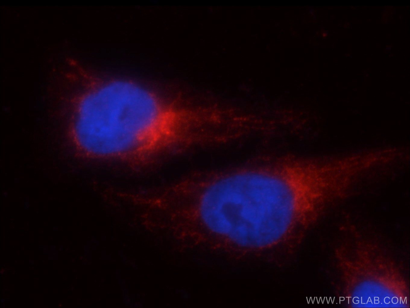 IF staining of HepG2 cells using GRP78 antibody (11587-1-AP) at a dilution of 1:25 and goat anti-rabbit IgG rhodamine-labelled secondary antibody