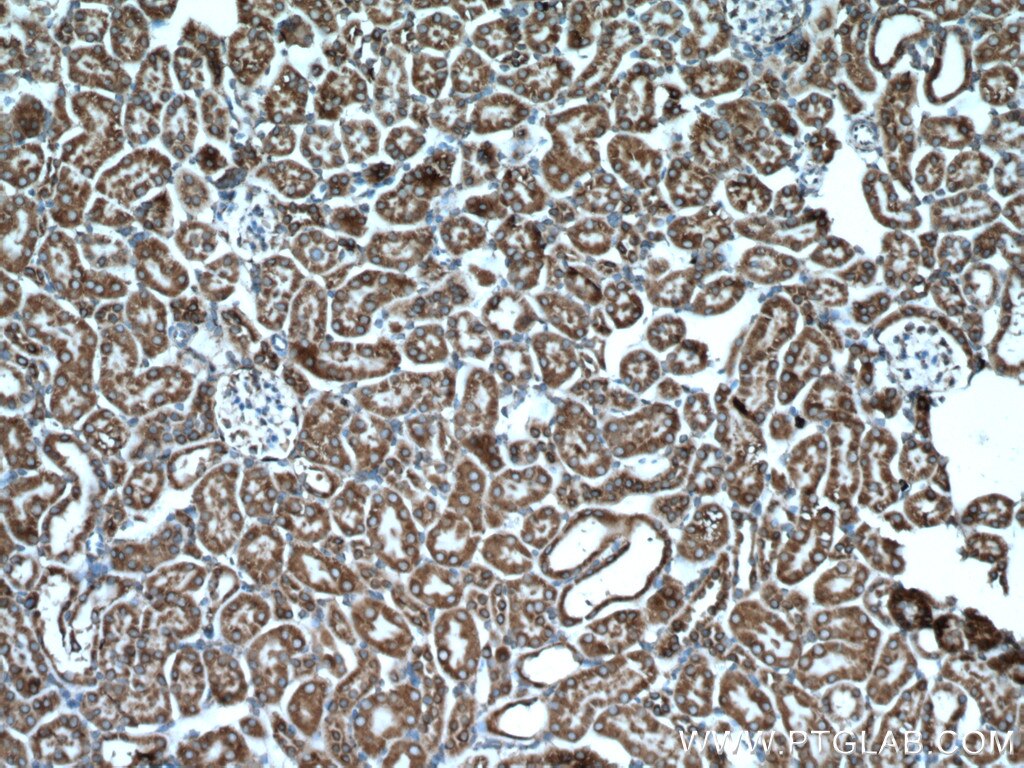 GRP78/BIP Antibody IHC mouse kidney tissue 11587-1-AP