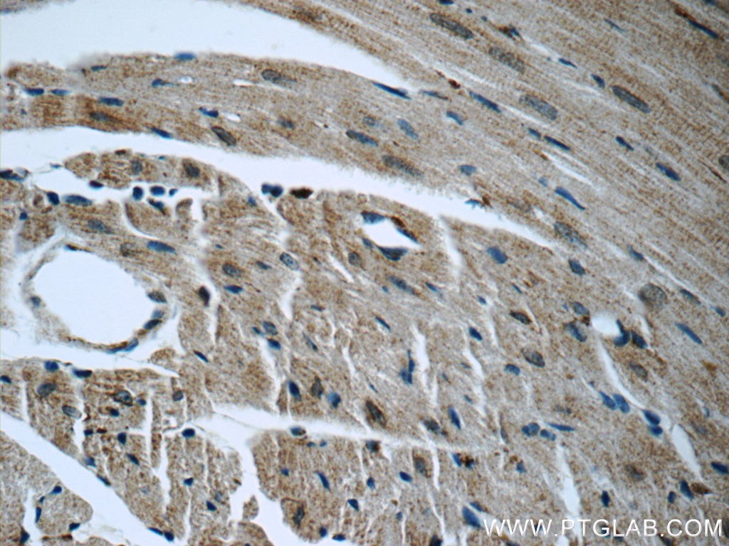 GRP78/BIP Antibody IHC mouse heart tissue 11587-1-AP