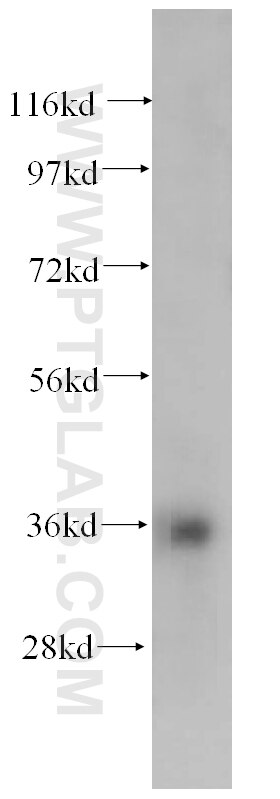 HMOX2 Antibody WB K-562 cells 14817-1-AP