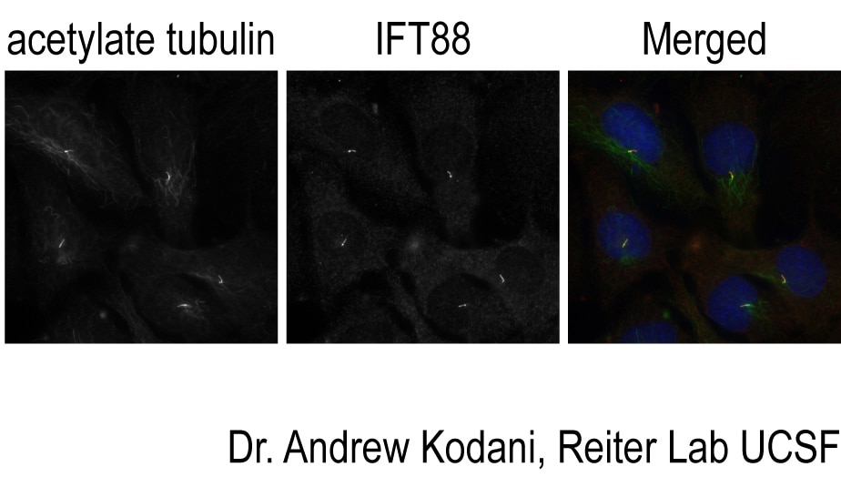 IFT88 Antibody IF hTERT-RPE1 cells 13967-1-AP