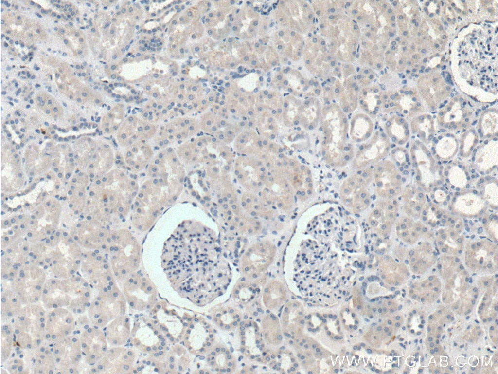 IL-1 Beta Antibody IHC human kidney tissue 16806-1-AP