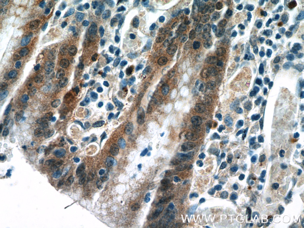 IL-1RA Antibody IHC human stomach tissue 10844-1-AP