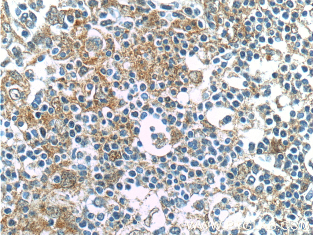 IL-6 Antibody IHC human spleen tissue 21865-1-AP