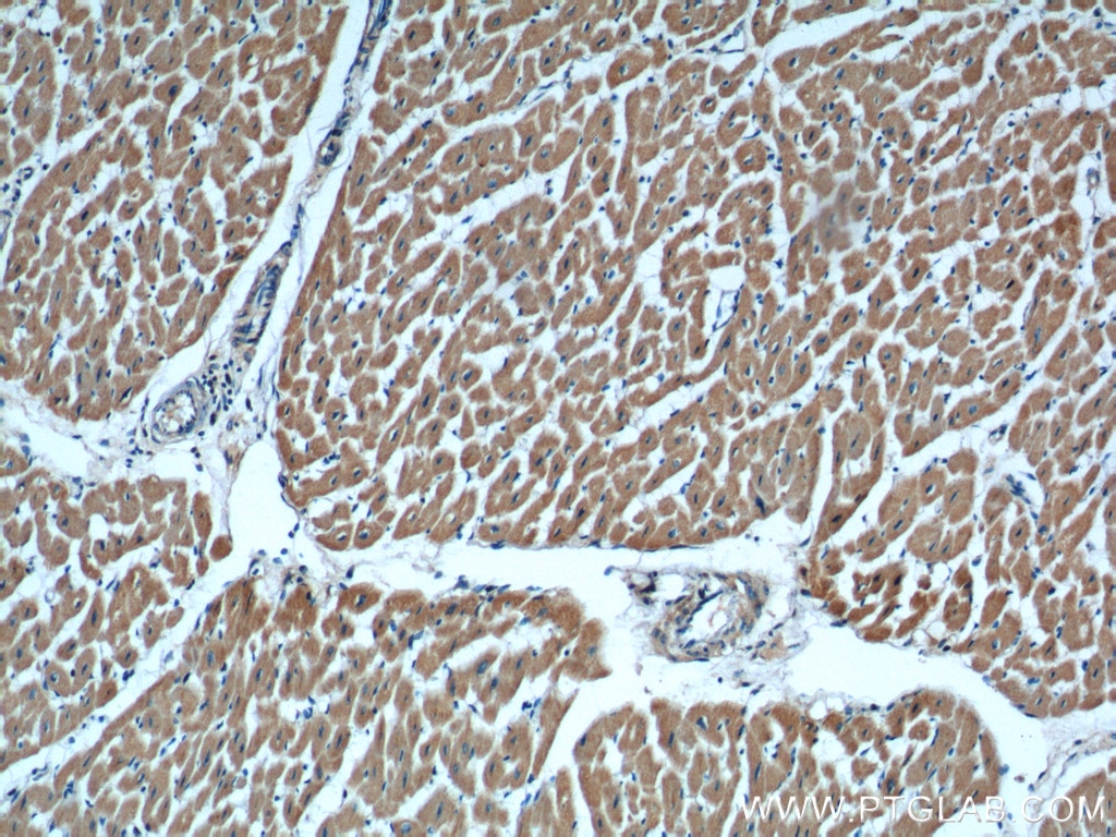 IL-6 Antibody IHC human heart tissue 66146-1-Ig